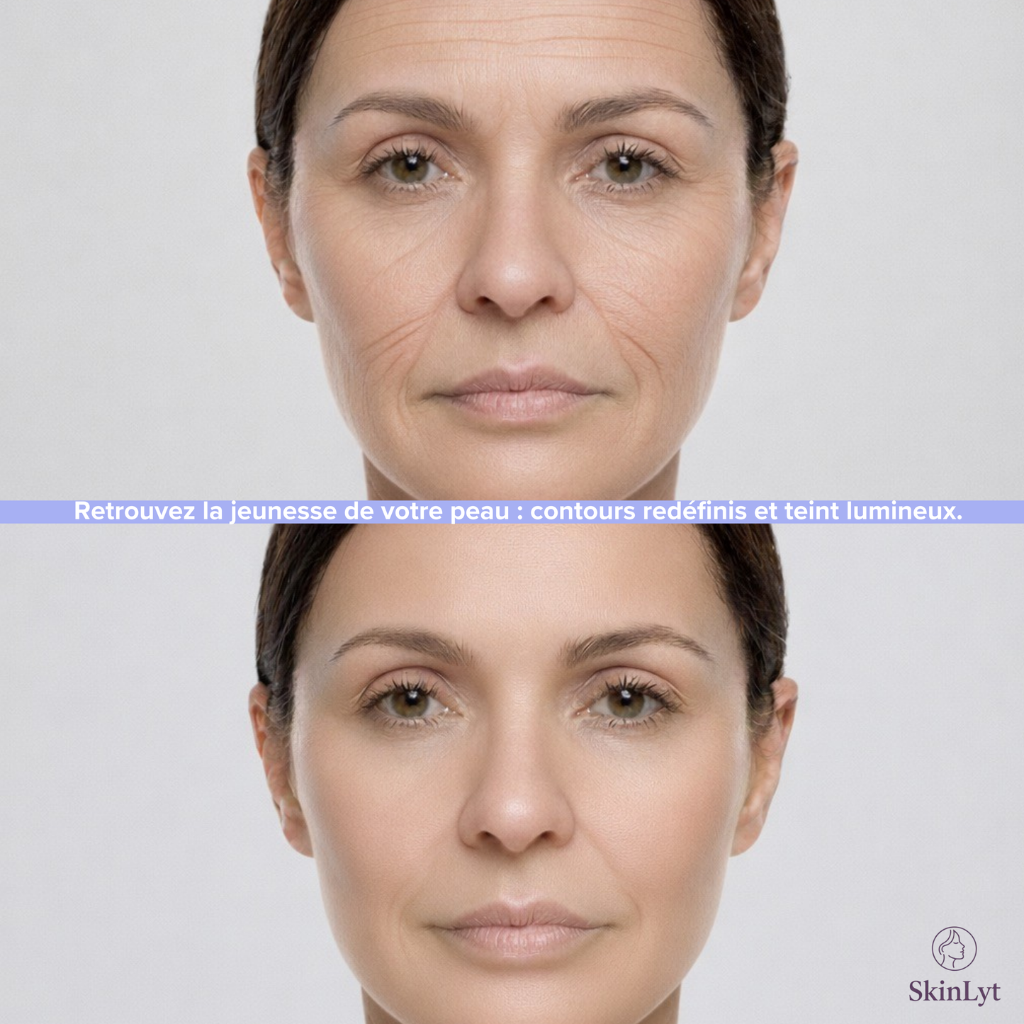 SkinLyt – L'appareil liftant qui rajeunit votre peau